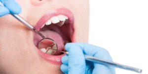 Root Canal: Debunking 6 Common Myths